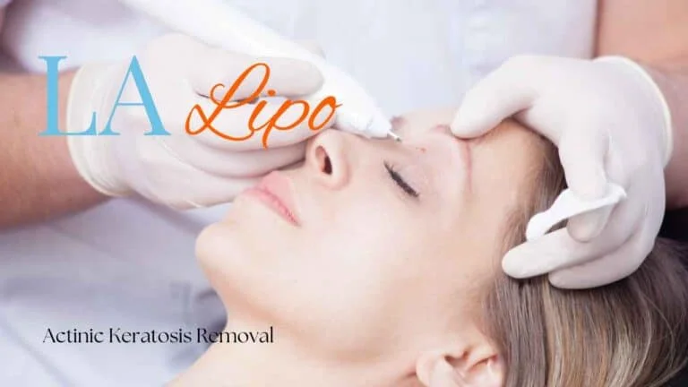 Woman receiving Actinic Keratosis Removal Treatment Bushey