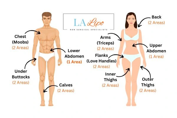 LA LIPO Cryolipolysis Areas Bushey