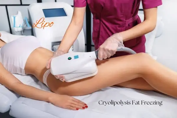 Woman receiving coolsculpting Bushey treatment on her thighs