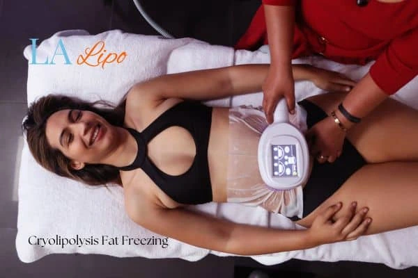woman getting cryolipolysis Bushey
