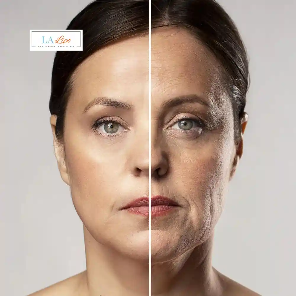 How Can You Tell If Non-Surgical Skin Tightening Is Right for You Bushey?