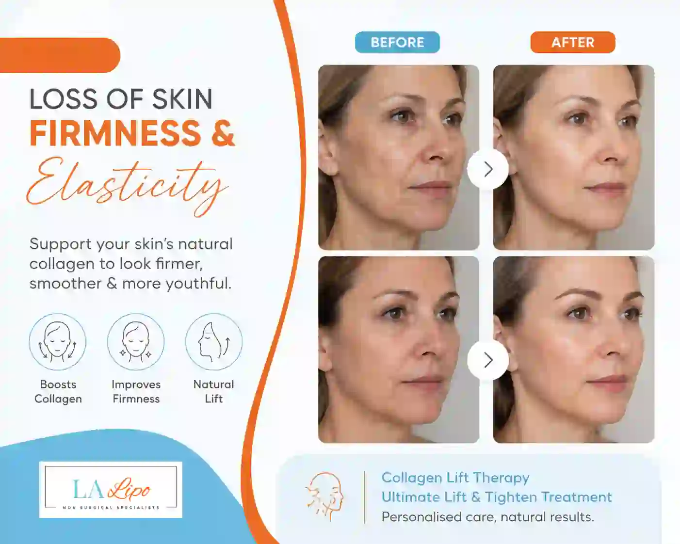 Sign #7: Loss of Skin Firmness and Elasticity Bushey